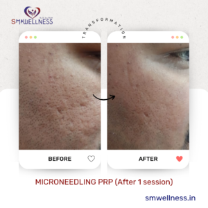 20221213_185229_0000