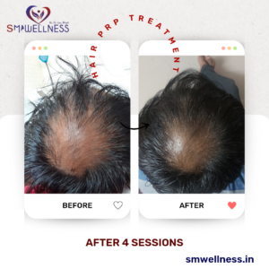 20221213_190112_0000